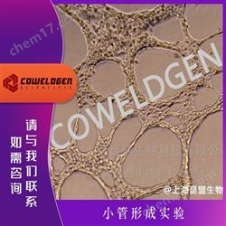 Tube Formation Assay小管形成實(shí)驗